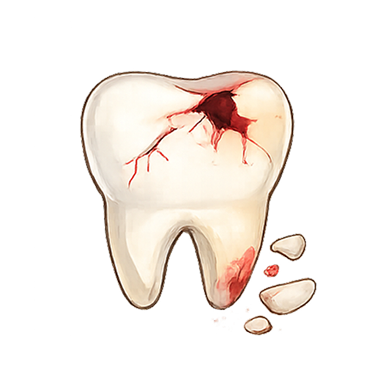 Chipped broken or fractured tooth