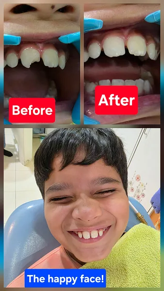 Gentle child dental treatment nashik.